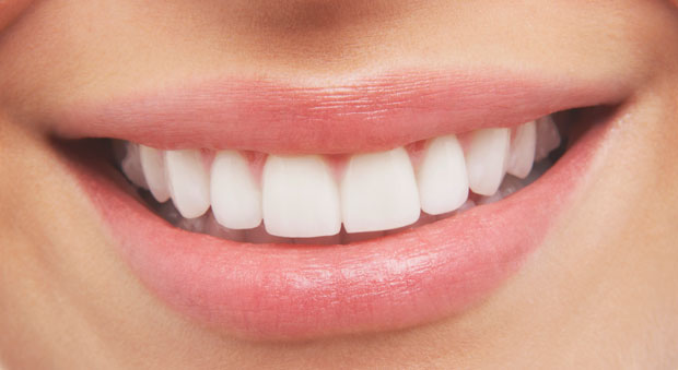 At Home Versus In Office Whitening?