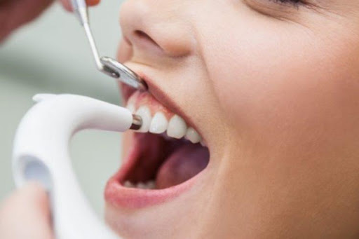 Tooth Fracture: Causes and Treatment